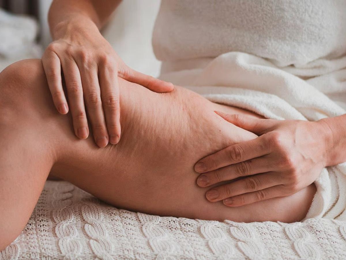 Ruolo della fisioterapia nel trattamento del lipedema
